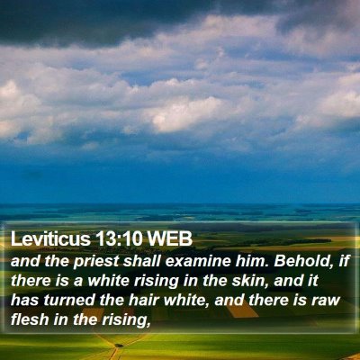 Leviticus 13:10 WEB Bible Verse Image
