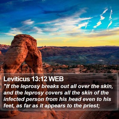 Leviticus 13:12 WEB Bible Verse Image