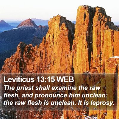 Leviticus 13:15 WEB Bible Verse Image