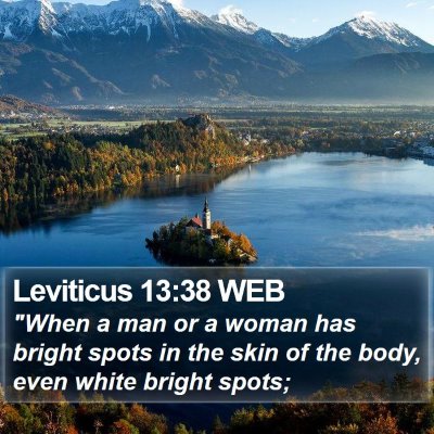 Leviticus 13:38 WEB Bible Verse Image