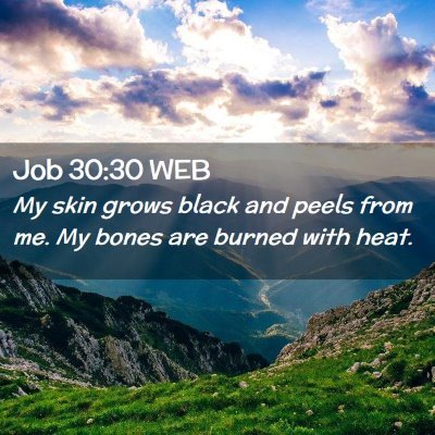 Picture 02 - Job 30:30 WEB - My skin grows black and peels from me. My bones - Bible Verse Picture