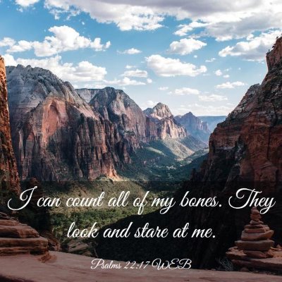 Picture 03 - Psalms 22:17 WEB - I can count all of my bones. They look and stare - Bible Verse Picture
