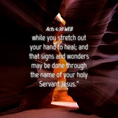 Picture 04 - Acts 4:30 WEB - while you stretch out your hand to heal; and that - Bible Verse Picture